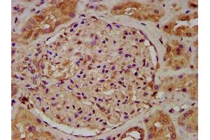 IHC image of ABIN7174627 diluted at 1:200 and staining in paraffin-embedded human kidney tissue performed on a Leica BondTM system. (UGT1A6 抗体  (AA 278-410))