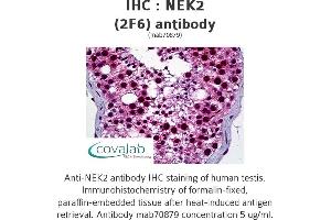Image no. 1 for anti-NIMA (Never in Mitosis Gene A)-Related Kinase 2 (NEK2) (AA 331-445) antibody (ABIN1723728) (NEK2 抗体  (AA 331-445))