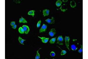 Immunofluorescence (IF) image for anti-Keratin 10 (KRT10) (AA 1-584) antibody (ABIN7157372)
