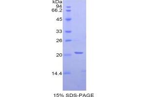 SDS-PAGE analysis of Rat NAGase Protein.