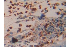 Immunohistochemistry (IHC) image for anti-Azurocidin 1 (AZU1) (AA 23-247) antibody (ABIN7433654)