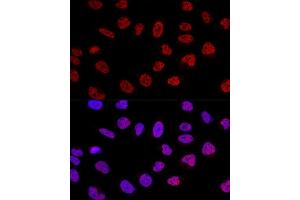 Confocal immunofluorescence analysis of U2OS cells using BC Polyclonal Antibody (ABIN6127480, ABIN6137479, ABIN6137480 and ABIN6220613) at dilution of 1:100. (BCAS2 抗体  (AA 1-225))