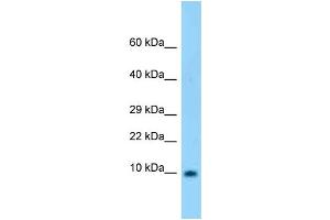 WB Suggested Anti-S100b Antibody Titration: 1. (S100B 抗体  (N-Term))