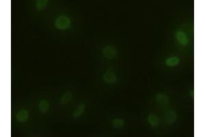 Immunofluorescent staining of HeLa cells using anti-ACTN1 mouse monoclonal antibody (ABIN2452359). (ACTN1 抗体  (AA 650-893))