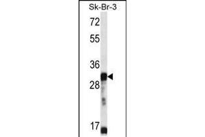 Western blot analysis in SK-BR-3 cell line lysates (35ug/lane). (OR5D13 抗体  (AA 172-199))