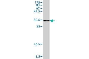 Western Blot detection against Immunogen (33. (AKR1B10 抗体  (AA 76-143))
