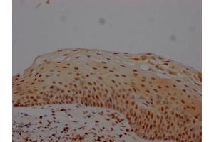 IHC image of ABIN7127619 diluted at 1:100 and staining in paraffin-embedded human tonsil tissue performed on a Leica BondTM system. (Recombinant MGMT 抗体)