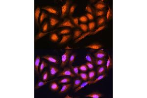 Immunofluorescence (IF) image for anti-Proteasome (Prosome, Macropain) 26S Subunit, Non-ATPase, 4 (Psmd4) (AA 1-377) antibody (ABIN3021330)