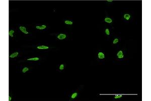 Immunofluorescence of monoclonal antibody to MARK2 on HeLa cell. (MARK2 抗体  (AA 401-500))