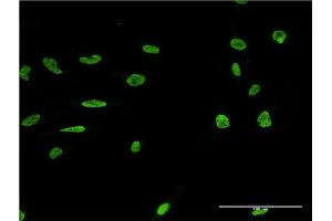 Immunofluorescence of monoclonal antibody to MARK2 on HeLa cell.