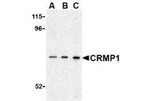 Western blot analysis of CRMP1 in 3T3 cell lysate with AP30242PU-N CRMP1 antibody at (A) 0. (CRMP1 抗体  (C-Term))