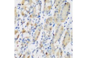 Immunohistochemistry of paraffin-embedded human gastric using RRM1 antibody at dilution of 1:200 (40x lens). (RRM1 抗体)