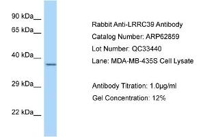 Western Blotting (WB) image for anti-Leucine Rich Repeat Containing 39 (LRRC39) (C-Term) antibody (ABIN2789270) (LRRC39 抗体  (C-Term))