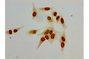 Immunocytochemistry analysis of Hela cells using ABIN7139190 at dilution of 1:100 (HIST1H1C 抗体  (acLys62))