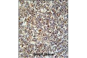 CLM1 Antibody (N-term) (ABIN653906 and ABIN2843144) immunohistochemistry analysis in formalin fixed and paraffin embedded human lymph tissue followed by peroxidase conjugation of the secondary antibody and DAB staining. (IREM1 抗体  (N-Term))