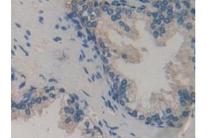Immunohistochemistry (IHC) image for anti-Biglycan (BGN) (AA 230-366) antibody (ABIN7438334)