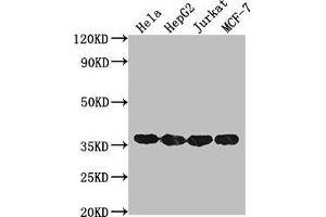 Western Blot Positive WB detected in: Hela whole cell lysate, HepG2 whole cell lysate, Jurkat whole cell lysate, MCF-7 whole cell lysate All lanes: GAPDH antibody at 1:2000 Secondary Goat polyclonal to mouse IgG at 1/50000 dilution Predicted band size: 36 KDa Observed band size: 36 KDa Exposure time: 30s (GAPDH 抗体  (AA 3-335))
