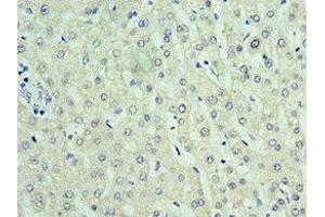 Immunohistochemistry of paraffin-embedded human liver tissue using ABIN7168307 at dilution of 1:100 (UPF0568 Protein C14orf166 (RTRAF) (AA 1-244) 抗体)