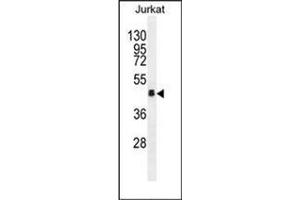 Western blot analysis of OR4N4 Antibody (N-term) in Jurkat cell line lysates (35ug/lane). (OR4N4 抗体  (N-Term))