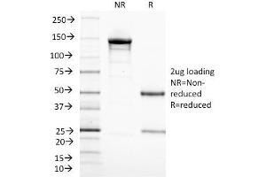 SDS-PAGE Analysis Purified CD3 epsilon Monoclonal Antibody (C3e/1308). (CD3 epsilon 抗体  (AA 23-119))