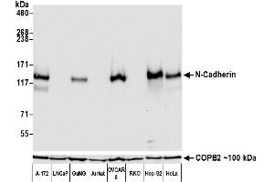 Western Blotting (WB) image for anti-Cadherin 2 (CDH2) (AA 160-724) antibody (ABIN7453333)