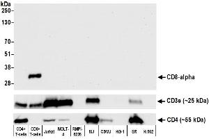 Western Blotting (WB) image for anti-CD8a Molecule (CD8A) (AA 185-235) antibody (ABIN7449561) (Recombinant CD8 alpha 抗体  (AA 185-235))