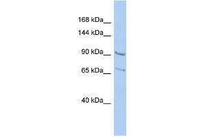 WB Suggested Anti-RALGDS Antibody Titration: 0. (RALGDS 抗体  (N-Term))