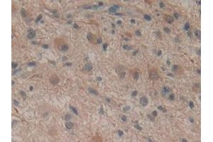 Immunohistochemistry (IHC) image for anti-Stromal Cell Derived Factor 2 (SDF2) (AA 19-211) antibody (ABIN7439993)