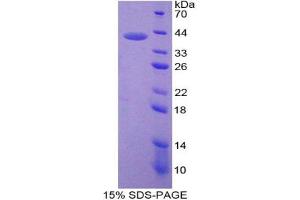 SDS-PAGE analysis of Mouse Neuromedin B Protein. (Neuromedin B 蛋白)