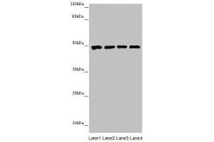 Western blot All lanes: CYP3A43 antibody at 2.
