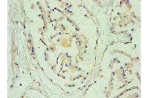 Immunohistochemistry (IHC) image for anti-Sulfotransferase Family, Cytosolic, 2B, Member 1 (SULT2B1) (AA 1-365) antibody (ABIN7170965)