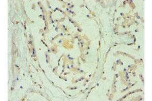 Immunohistochemistry of paraffin-embedded human prostate tissue using ABIN7170965 at dilution of 1:100 (SULT2B1 抗体  (AA 1-365))