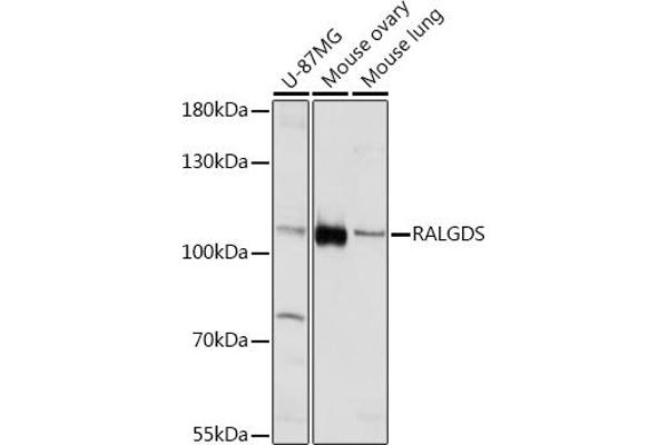 RALGDS 抗体