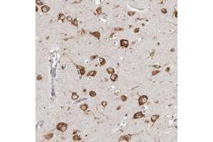 Immunohistochemical staining of human cerebral cortex with FAM167B polyclonal antibody  shows strong cytoplasmic positivity in neuronal cells. (FAM167B 抗体)