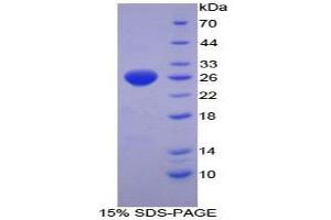 SDS-PAGE analysis of Mouse TrxR1 Protein. (TXNRD1 蛋白)