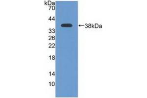Detection of Recombinant ATR, Human using Polyclonal Antibody to Ataxia Telangiectasia And Rad3 Related Protein (ATR) (ATR 抗体  (AA 2353-2644))
