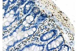 ABIN6263186 and ABIN6273137 at 1/100 staining Rat colorectal tissue by IHC-P. (MECP2 抗体  (C-Term))