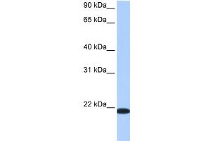 WB Suggested Anti-TMED4 Antibody Titration:  0. (TMED4 抗体  (Middle Region))