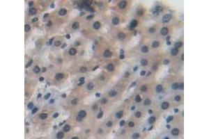Immunohistochemistry (IHC) image for anti-Isocitrate Dehydrogenase 1 (NADP+), Soluble (IDH1) (AA 78-330) antibody (ABIN1859251)