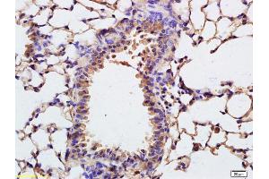 Immunohistochemistry (IHC) image for anti-Collagen, Type IV, alpha 3 (Goodpasture Antigen) Binding Protein (COL4A3BP) (AA 551-624) antibody (ABIN708836)