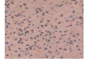 Detection of CHD3 in Mouse Brain Tissue using Polyclonal Antibody to Chromodomain Helicase DNA Binding Protein 3 (CHD3)