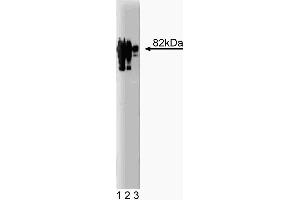 Western blot analysis of gamma-Catenin on a HeLa lysate. (JUP 抗体  (AA 553-738))
