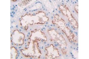 Used in DAB staining on fromalin fixed paraffin- embedded Kidney tissue