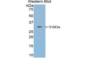 Western Blotting (WB) image for anti-TNFRSF1A-Associated Via Death Domain (TRADD) (AA 21-259) antibody (ABIN3202177) (TRADD 抗体  (AA 21-259))