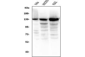 Western blot analysis of BubR1/BUB1B using anti-BubR1/BUB1B antibody (ABIN7600961).