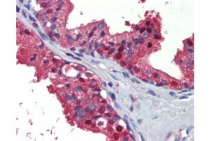 Human, Prostate: Formalin-Fixed Paraffin-Embedded (FFPE) (ACLY 抗体)