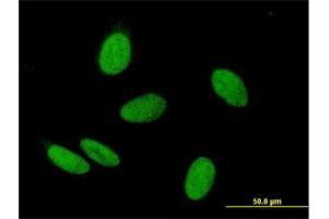 Immunofluorescence of purified MaxPab antibody to WHSC2 on HeLa cell. (WHSC2 抗体  (AA 1-528))