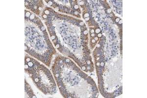Immunohistochemical staining of human duodenum with ZC3H3 polyclonal antibody  shows moderate cytoplasmic positivity in glandular cells at 1:50-1:200 dilution. (ZC3H3 抗体)