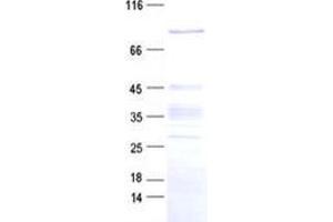 Western Blotting (WB) image for Zinc Finger Protein 226 (ZNF226) protein (His tag) (ABIN2735965)