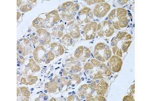 Immunohistochemistry (Paraffin-embedded Sections) (IHC (p)) image for anti-Striatin, Calmodulin Binding Protein 3 (STRN3) antibody (ABIN7262681)
